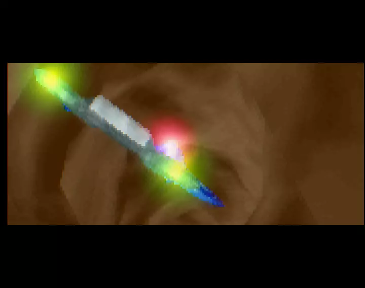 Incision (2000) by Exploder